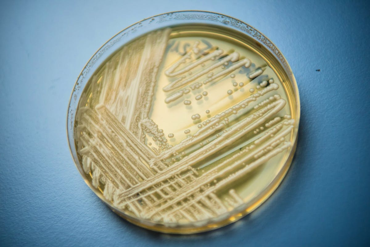 Expansion du champignon multirésistant Candida auris dans les établissements de santé de l’Union européenne
